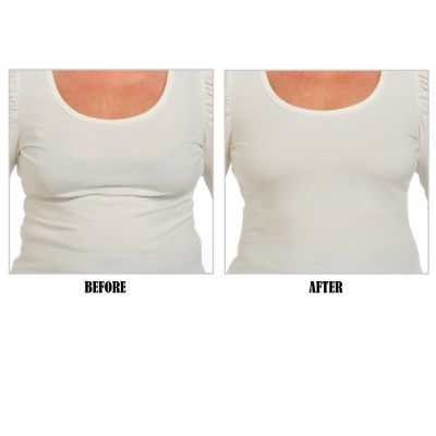 Before/After - Front