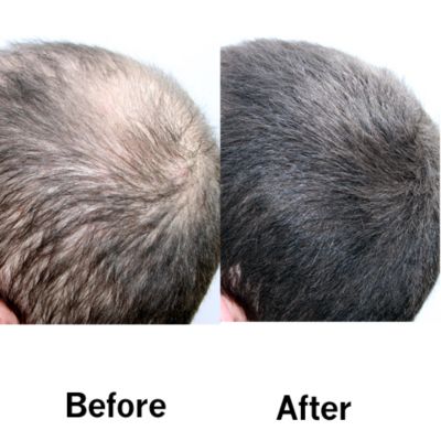 Before & After