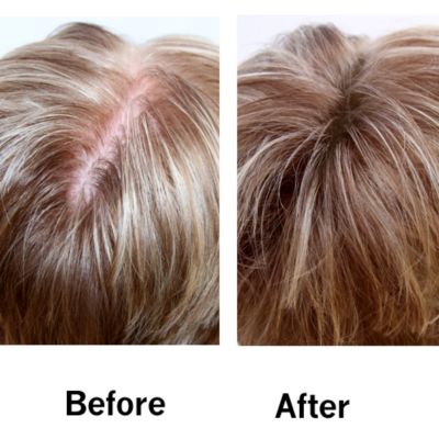 Before & After
