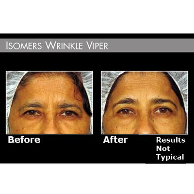 Before/After 1