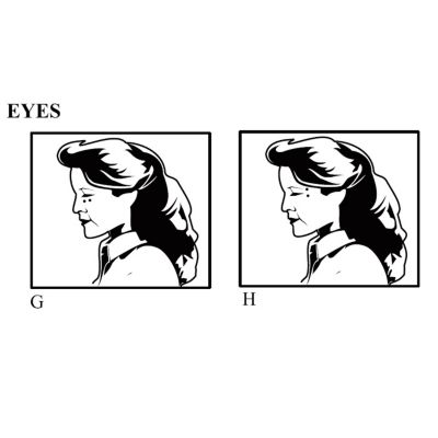 Unit Placement - Eyes