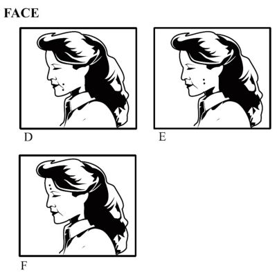 Unit Placement - Face