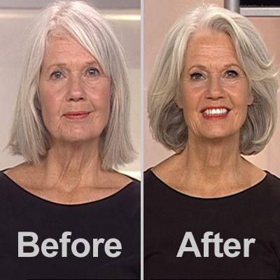 Before & After