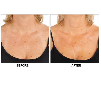 Before & After