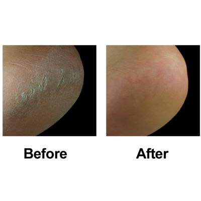 Before & After