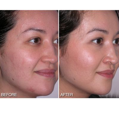 Before & After
